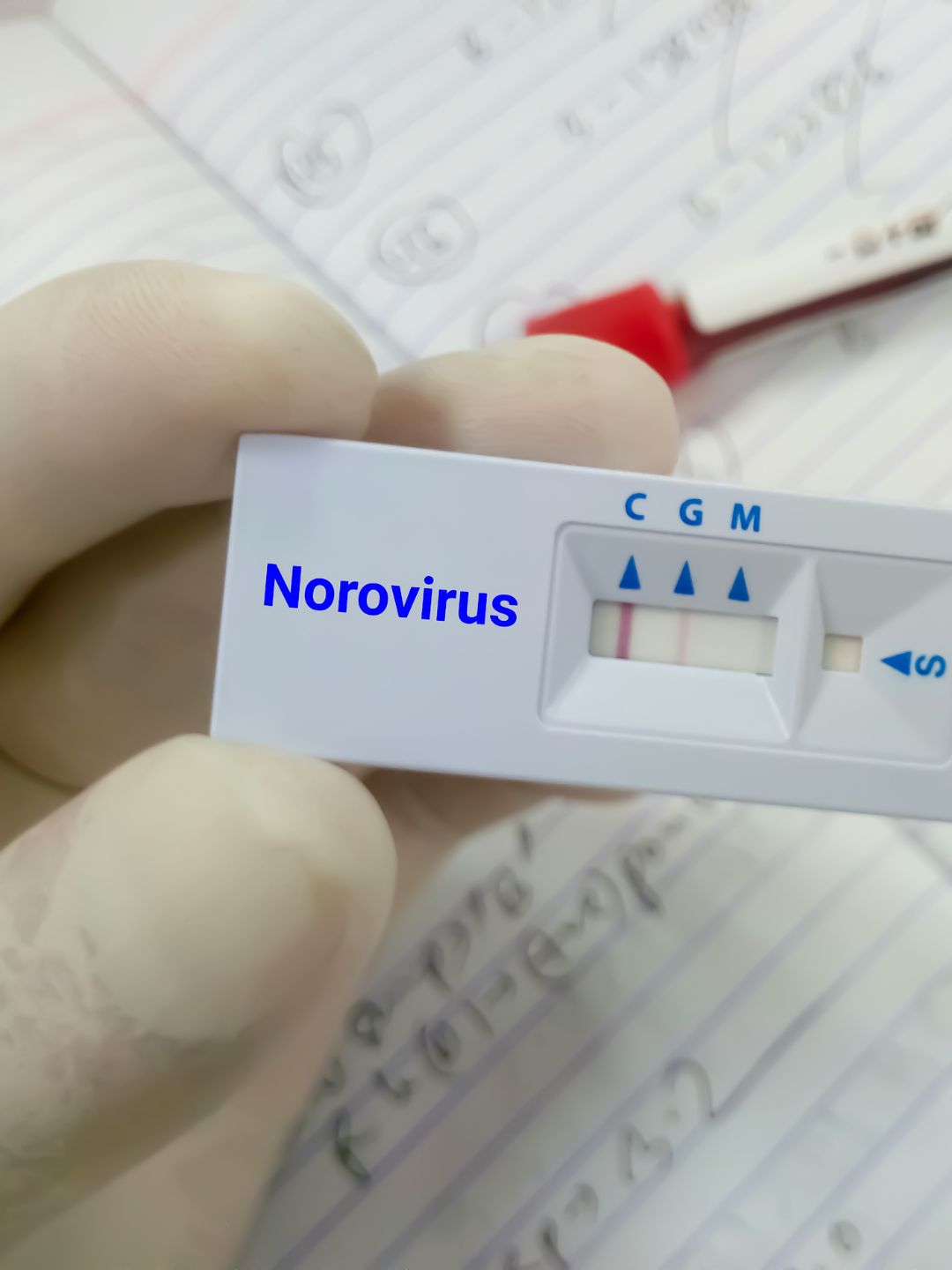 Norovirus, qué es y qué tomar para mejorar mi sistema inmune.