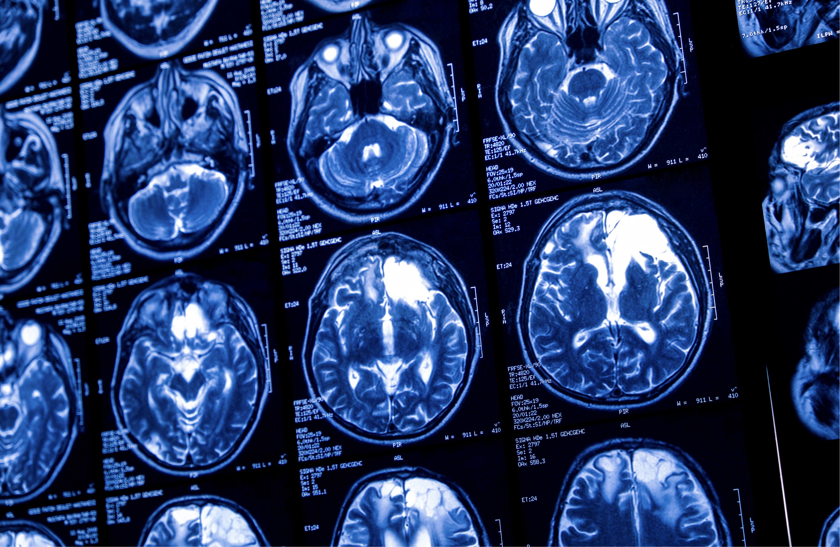 Un nuevo estudio pone el foco en el ubiquinol: la forma activa de la CoQ10 que podría ayudar al cerebro a envejecer mejor